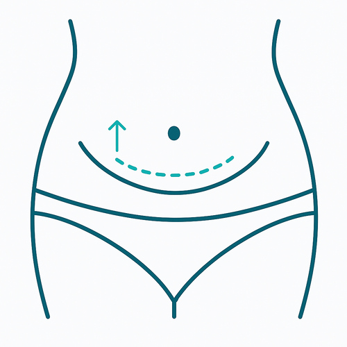 abdominoplasty - Mr. Gary Kode