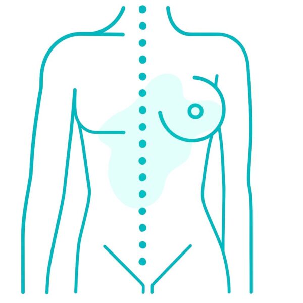 MTF, Implants Only Melbourne
Male to Female Surgery - Dr. Gary Kode Image